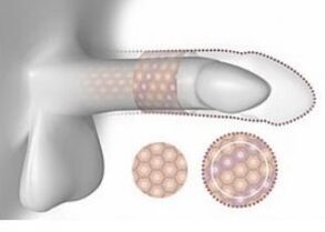 Increased penis size